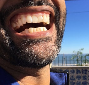 teeth gaps braces closed without